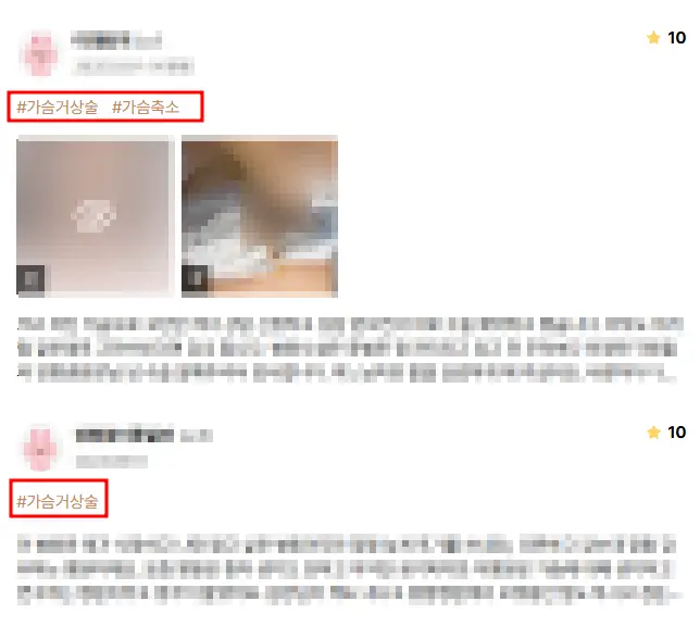 Унжсан хөхний мэс заслын үнэ — хөх өргөх мэс засал / имплант шаардлагатай тохиолдлуудыг ч тайлбарлая. <20 жилийн судалгааны туршлагад тулгуурласан зөвлөгөө> — нийтлэлийн зураг 7