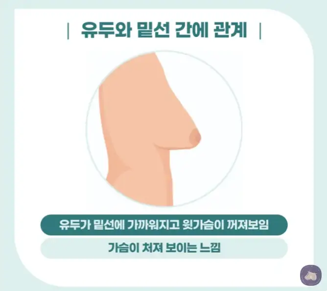 Хөх өргөх мэс заслын өртөг ба үнэ? Зөвхөн өнгөрсөн жилд 3023 хөхний имплантын мэс засал хийсэн эмнэлгээс хариулъя. — нийтлэлийн зураг 5