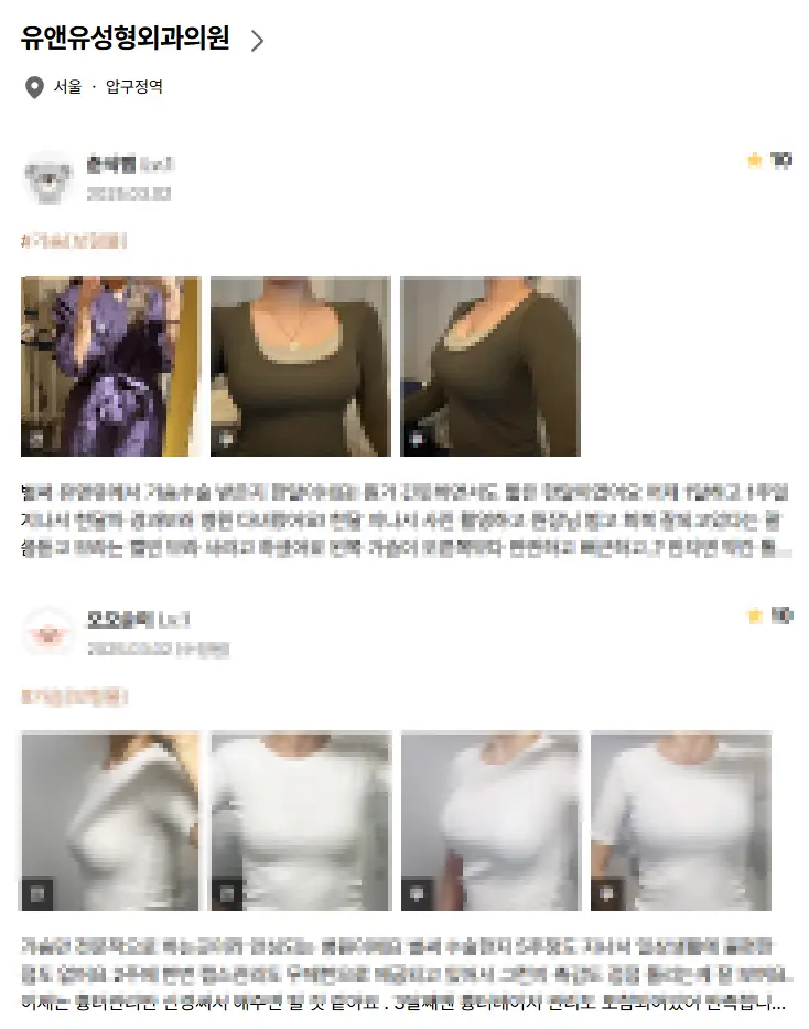 Хөх өргөх мэс заслын үнэ? Эхлээд үнийг нь хайх нь утга багатай. — нийтлэлийн зураг 7
