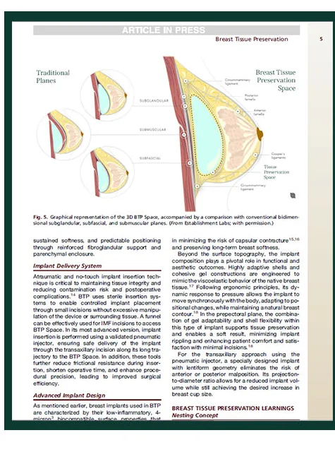 Clinics in Plastic Surgery-д нийтлэгдсэн өгүүллийн эх бие — 3D BTP Space бүдүүвч зураг