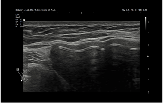 Healthy Breast Имплантын хэт авиан img6 m