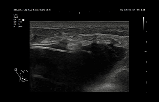 Healthy Breast Имплантын хэт авиан img8 m