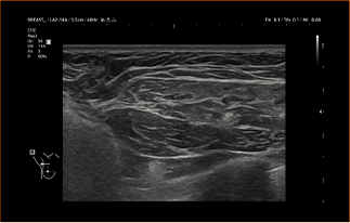 Healthy Breast Имплантын хэт авиан img9 m